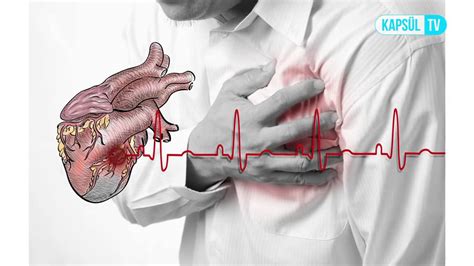 enfarktüs kalp krizi farkı